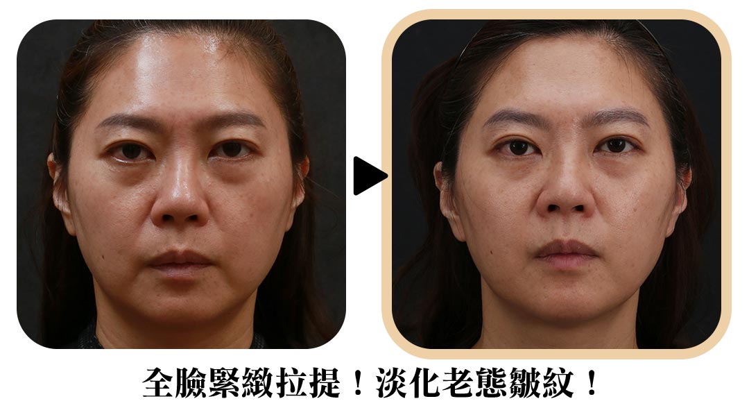 周爾康整形外科診所